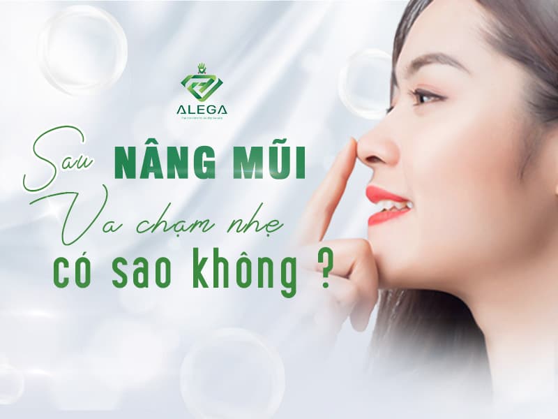 Sau Nâng mũi va chạm mạnh có sao không ? 8 1 1