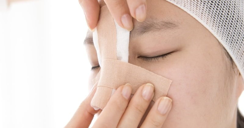 Biến chứng nâng mũi