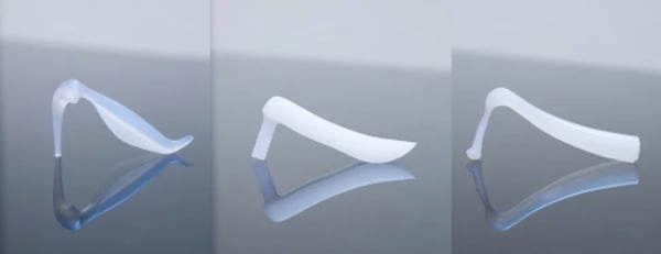 Nên nâng mũi sụn tự thân hay nhân tạo