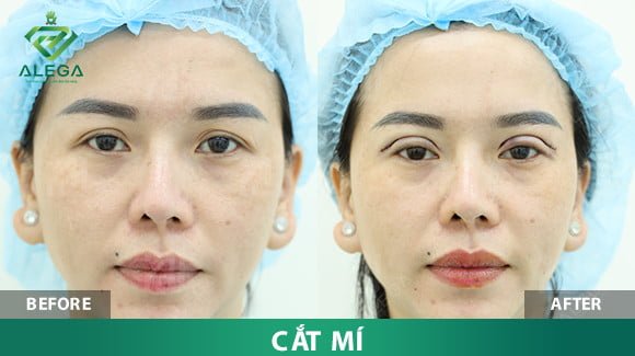 z4361044670127 c4ee6dee66d5f6c75c03af65d3d188f1