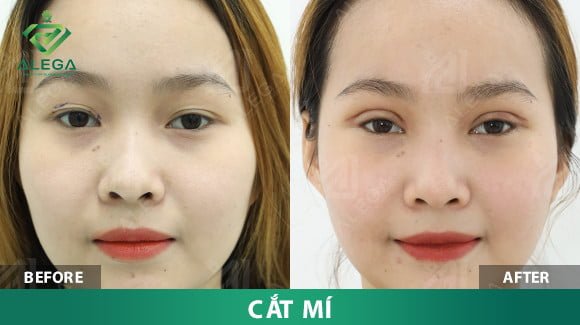 z4361044689511 8e07cb409c631138563bfacbecff6bae