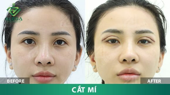 z4361044703408 b225e89e3b4901f4af0f95751112436b