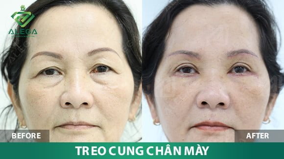 z4361044725768 250acdc1a03f8c55cf2ae229b2b673d6