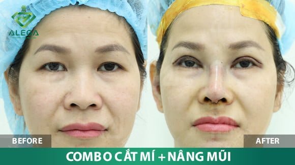 z4361044744062 e575108410b9c1683ce998db5d19877b