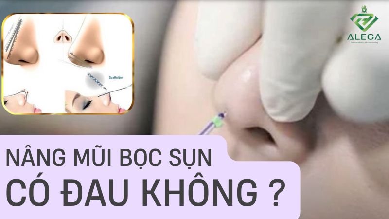 Nâng mũi bọc sụn có đau không ? 11 nang mui boc sun co dau khong