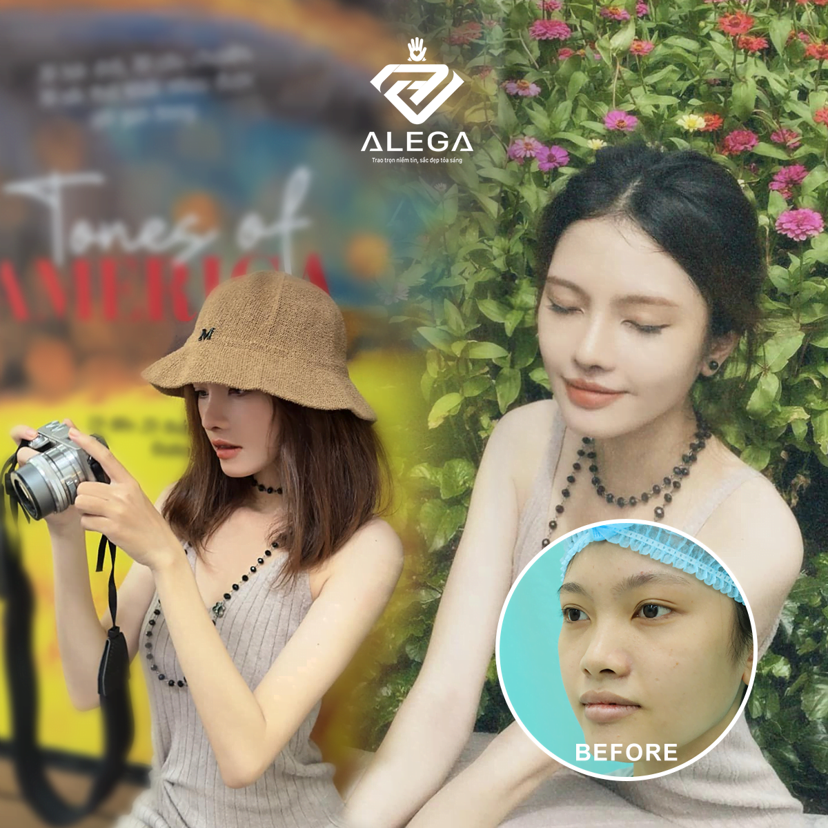 HỘI BẠN THÂN LÀM ĐẸP : NÂNG MŨI 2 - CHỈ TRẢ TIỀN 1 5 Hình ảnh feedback sau khi khách hàng nâng mũi cấu trúc