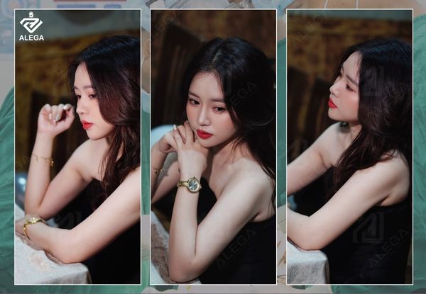 Hình ảnh khách hàng sau một thời gian nâng mũi tại Alega