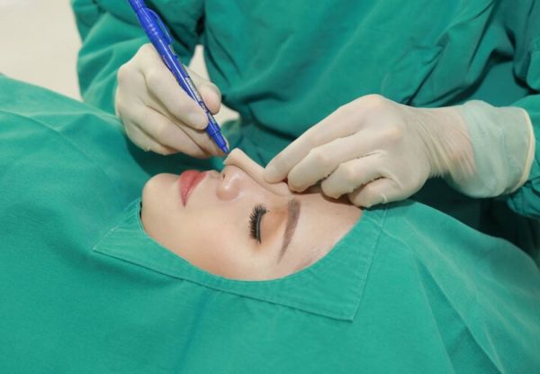 Dấu hiệu mũi không hợp sụn. Cách khắc phục như thế nào? 4 Tháo sụn mũi