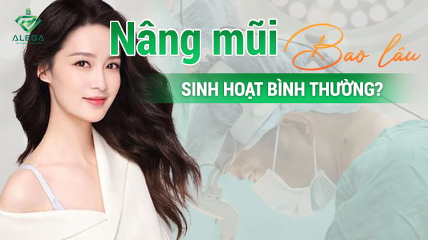 Nâng mũi bao lâu sinh hoạt bình thường.