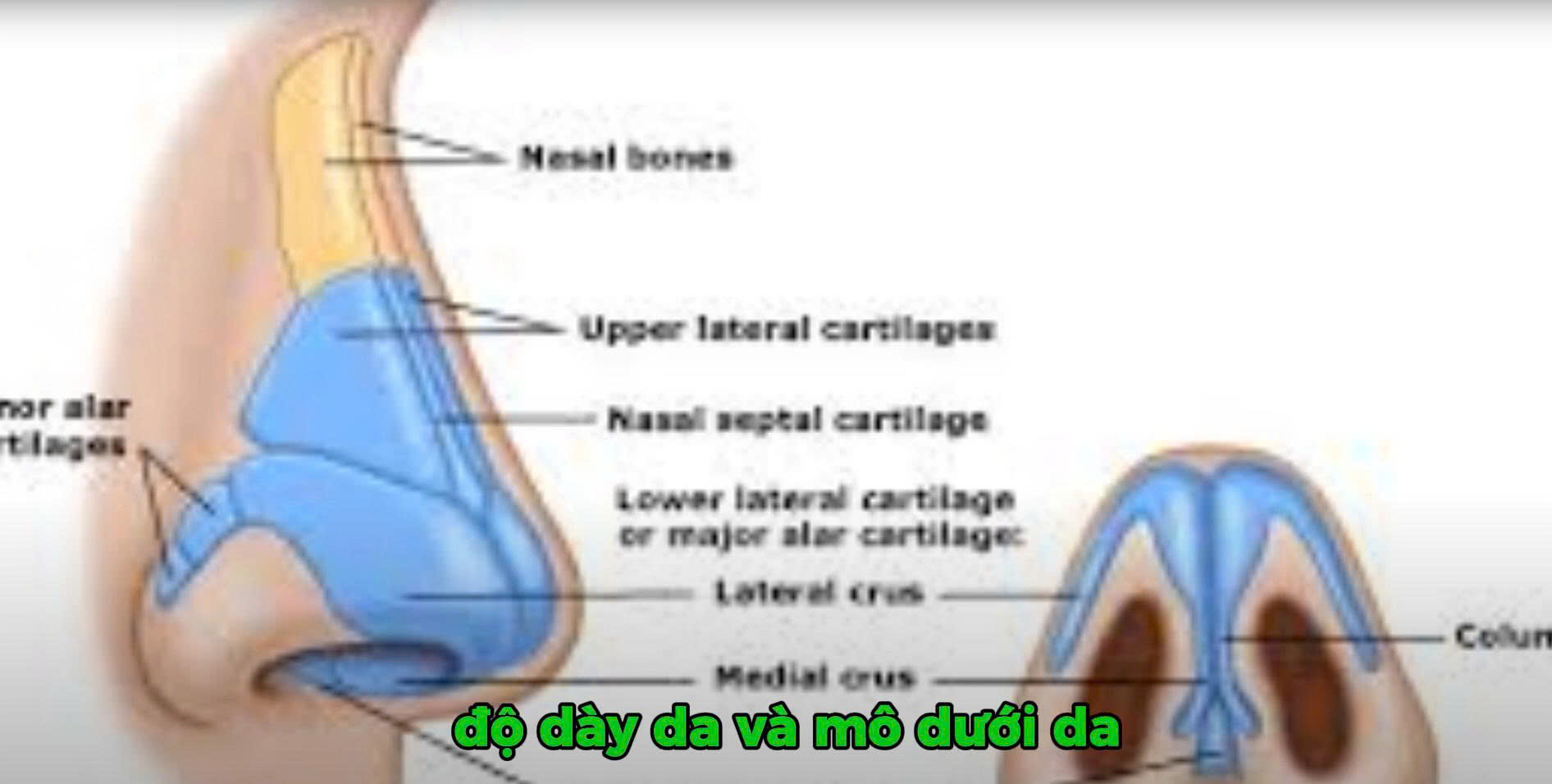 Nâng Mũi, Filler, Nâng Cấu Trúc: Lối Đi Đẹp Đúng Cách? 4 Lợi – hại rõ ràng: khi nào nên và tuyệt đối không nên kẹp?