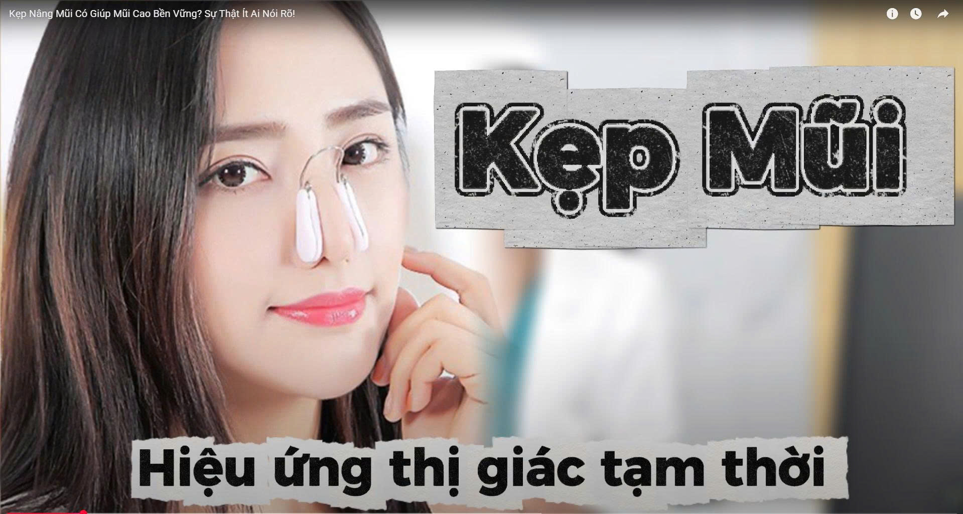 Nâng Mũi, Filler, Nâng Cấu Trúc: Lối Đi Đẹp Đúng Cách? 3 Sự thật khoa học: kẹp nâng mũi có giúp mũi cao bền vững?