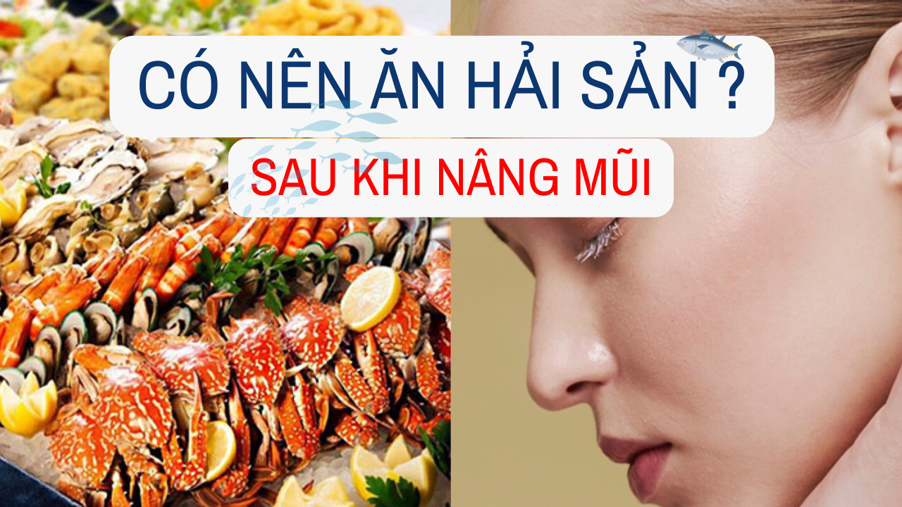 Nâng mũi có ăn hải sản được không? mốc an toàn & thực đơn 8 co nen an hai san sau khi nang mui