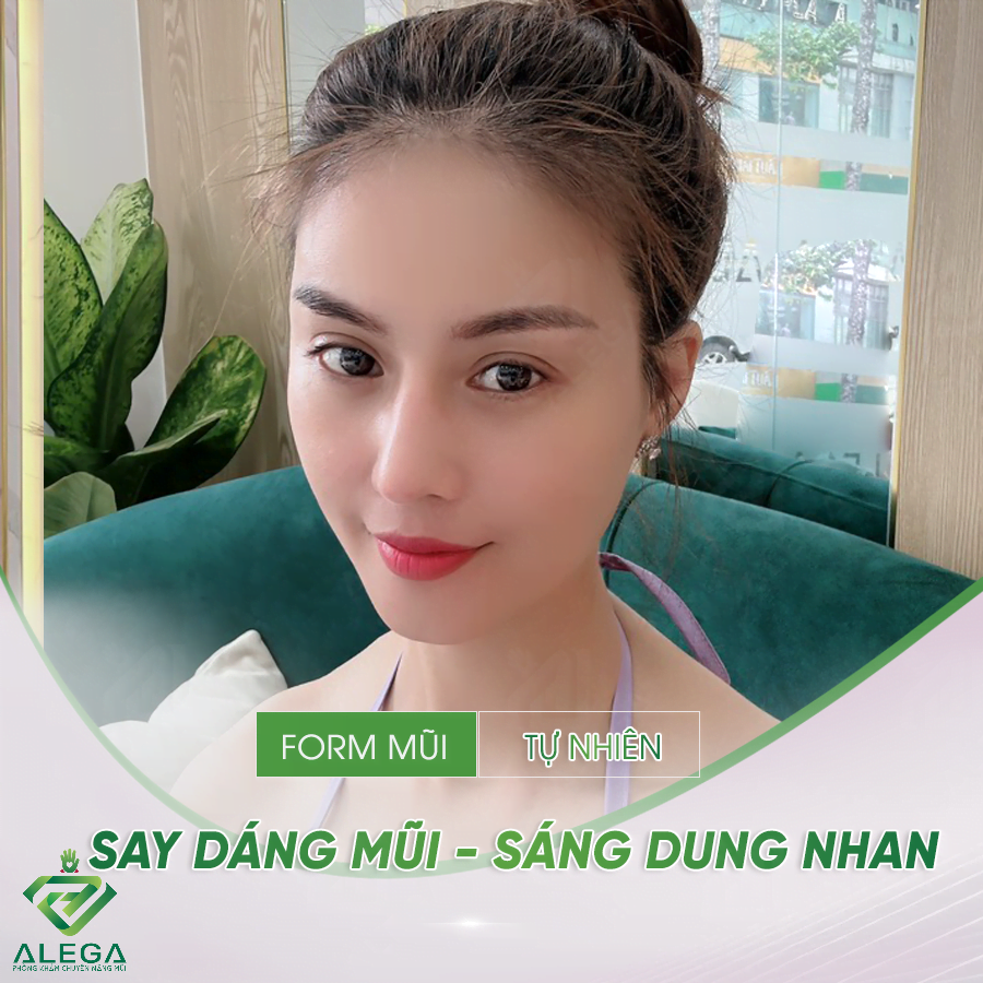 Nâng mũi Hàn Quốc 3 NC5 1