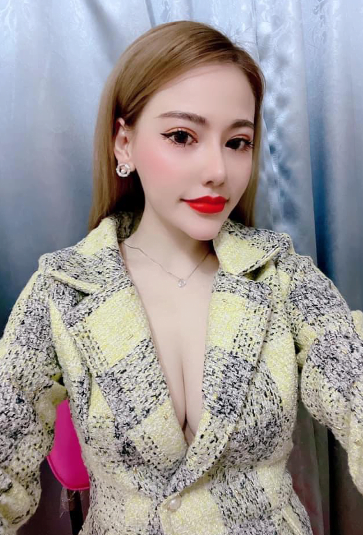 Nâng mũi Hàn Quốc 25 Nang mui han quoc