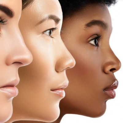 Sửa lại mũi hỏng 1 Nang mui qua cao qua thap