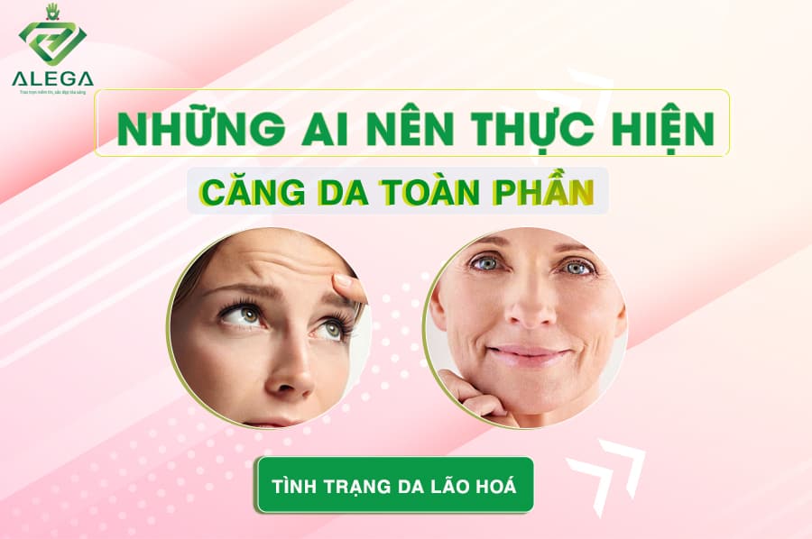 Căng da 3 Nhung ai nen thuc hien cang da toan phan