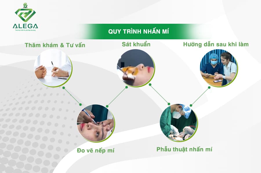 Nhấn mí 4 Quy trinh nhan mi