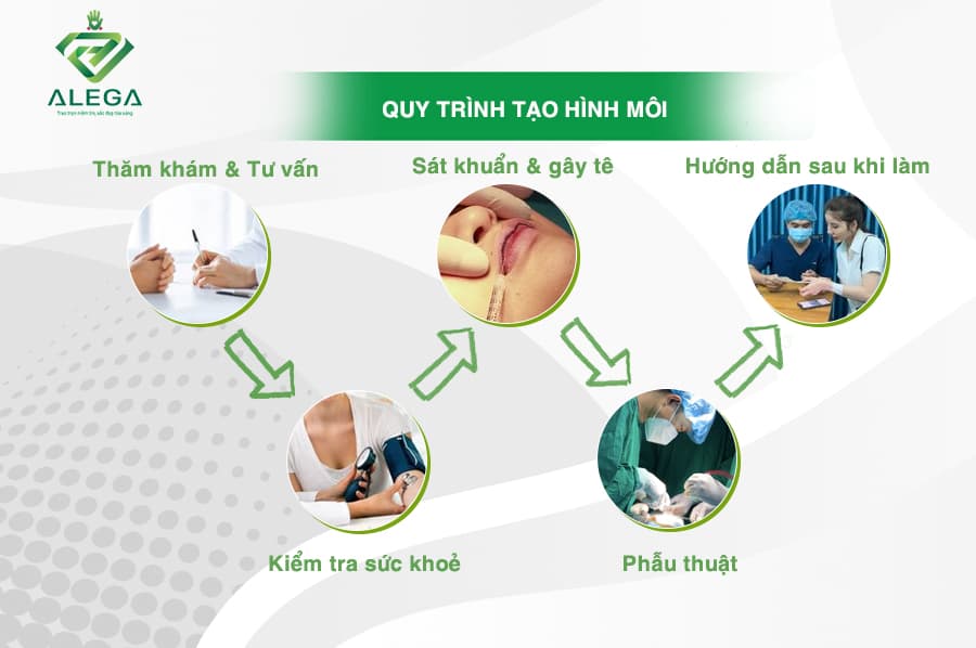 Tạo hình môi 3 Quy trinh tao hinh moi