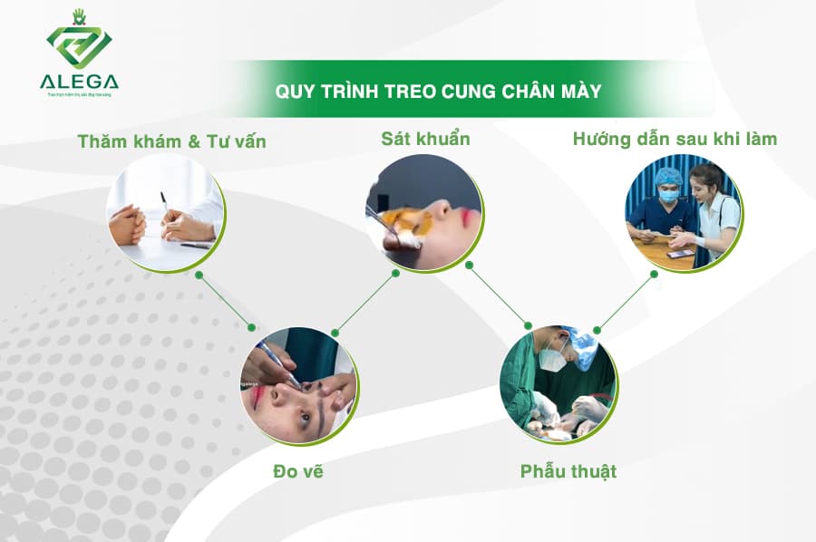 Quy trinh thuc hien 2