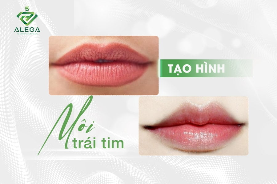Tạo hình môi 2 Tao hinh moi trai tim