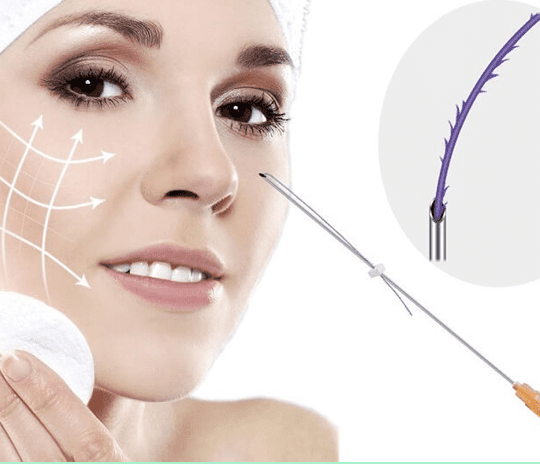 Nâng mũi Hàn Quốc 8 nang mui chi 20211103033124