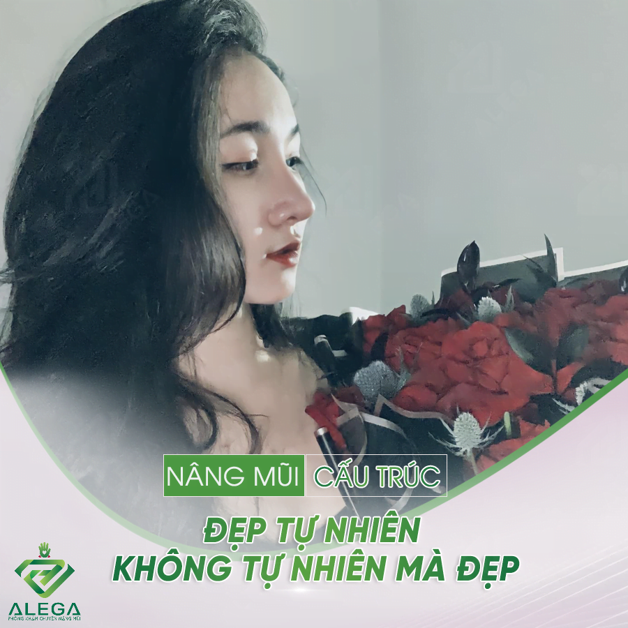 Nâng mũi bọc sụn 1 nc1