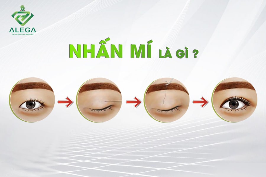 Nhấn mí 2 nhan mi 2
